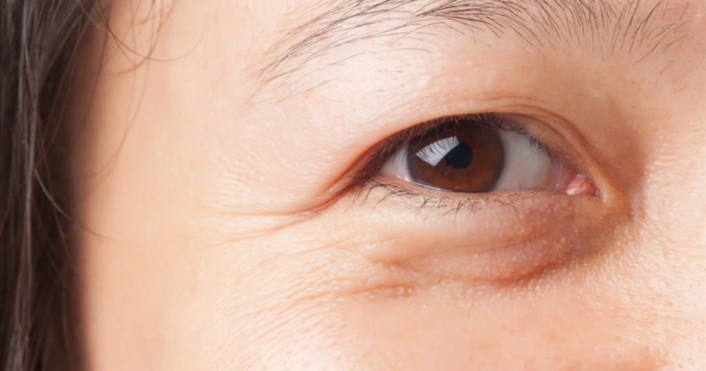 trẻ hóa da sớm cân nhắc công nghệ trẻ hóa giai đoạn từ 25 - 30 tuổi