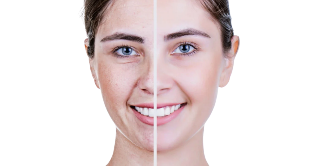 trẻ hóa da sớm có cần thiết