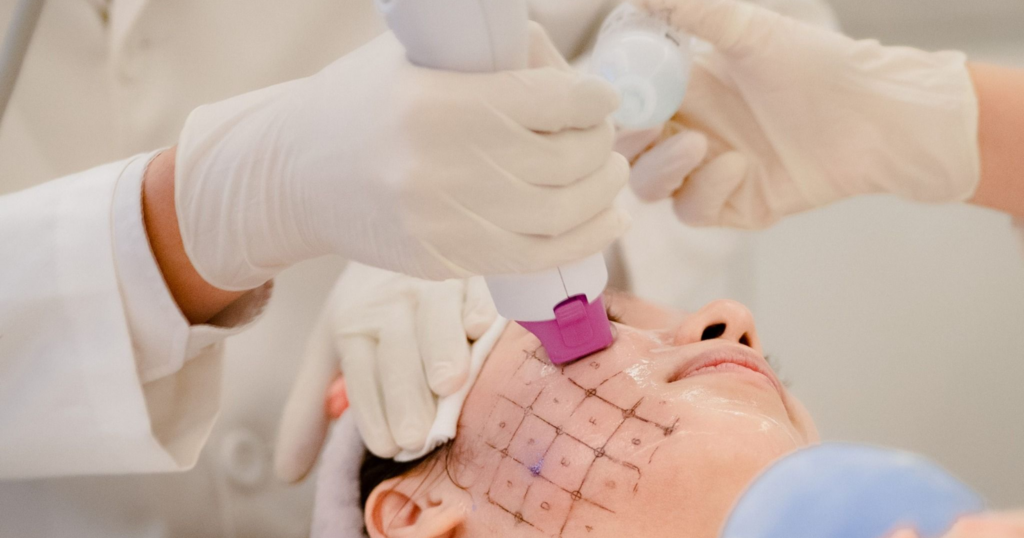 trẻ hóa da sớm bằng Thermage FLX