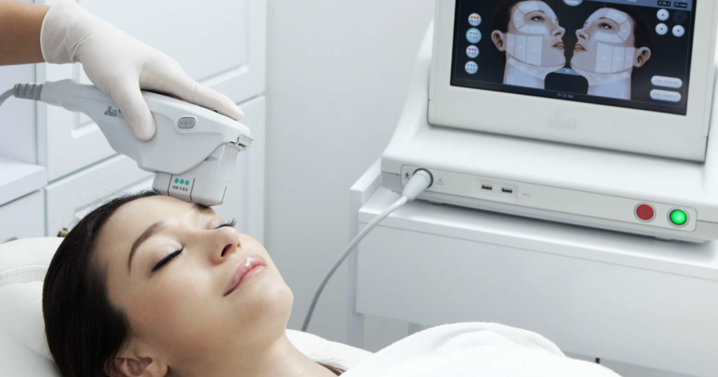 trẻ hóa da sớm bằng Ultherapy