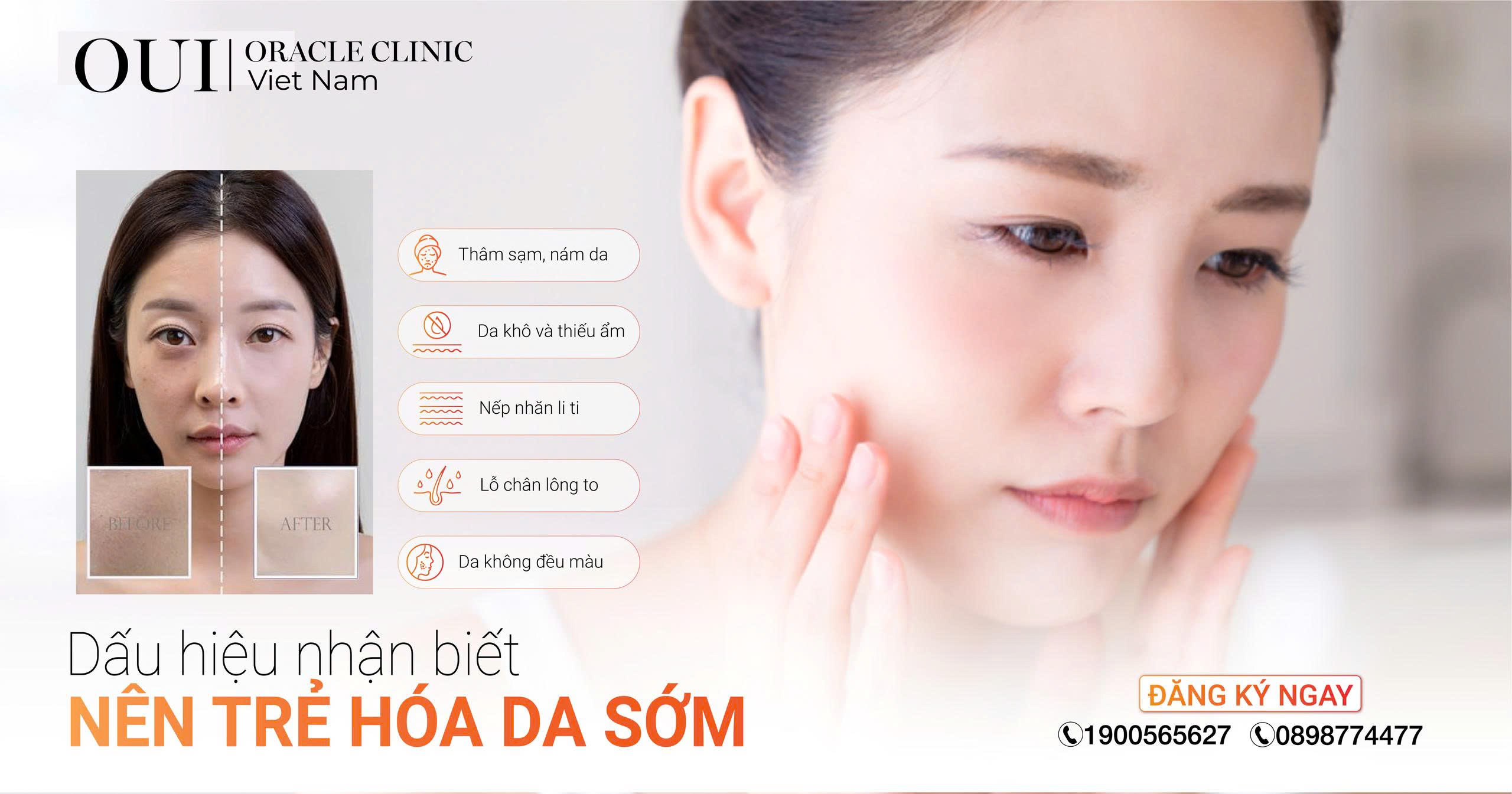 trẻ hóa da sớm