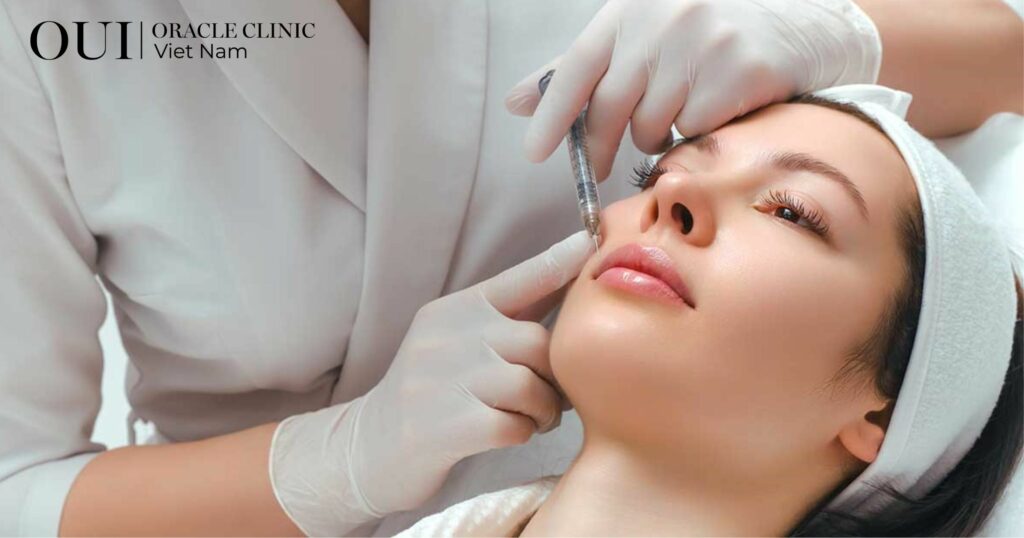Trị thâm mụn bao lâu thì hết liệu pháp Mesotherapy