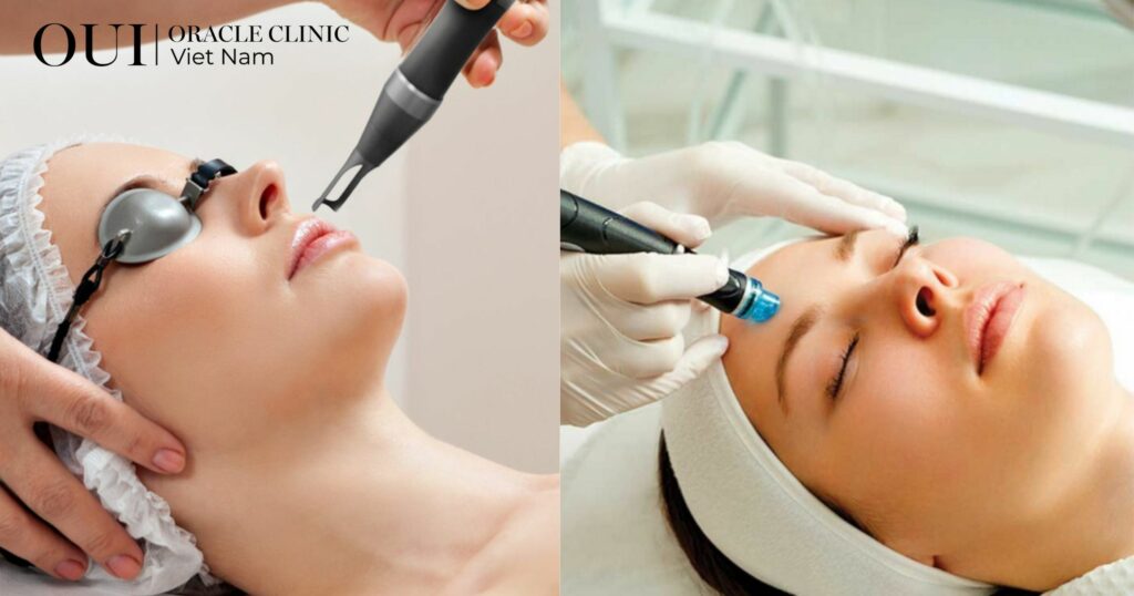 Trị thâm mụn bao lâu thì hết 