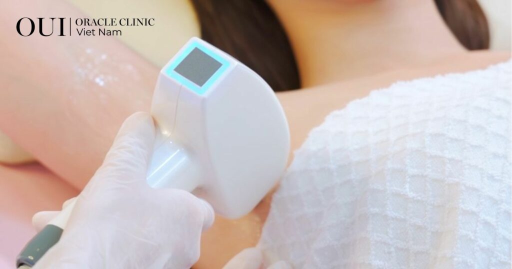 Triệt lông trước khi đi biển bao lâu