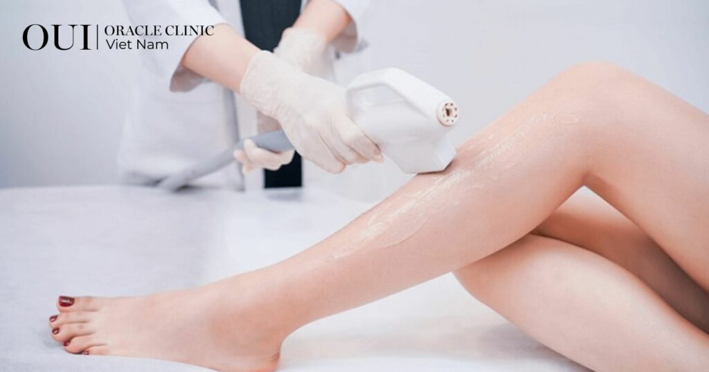 Triệt lông trước khi đi biển bao lâu