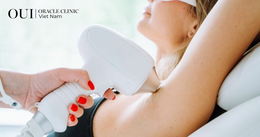 Triệt lông trước khi đi biển bao lâu