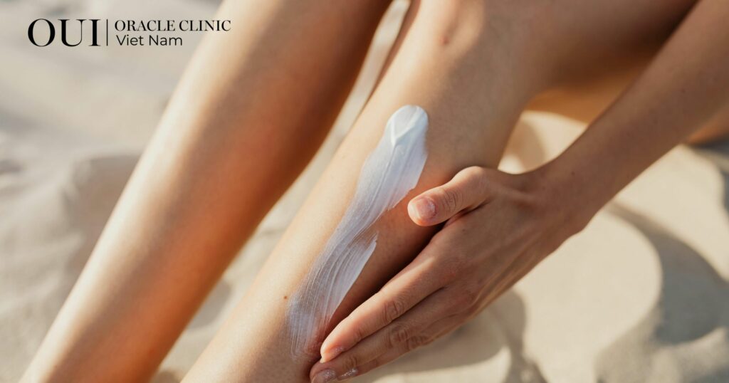 Triệt lông xong có bị bắt nắng không kem chống nắng là vật bất ly thân