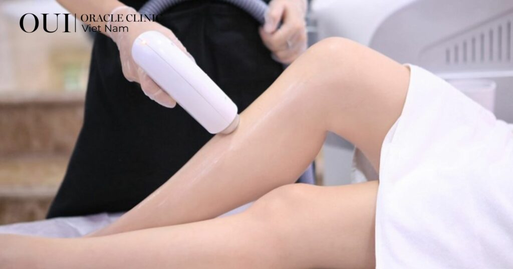 Triệt lông xong có bị bắt nắng không