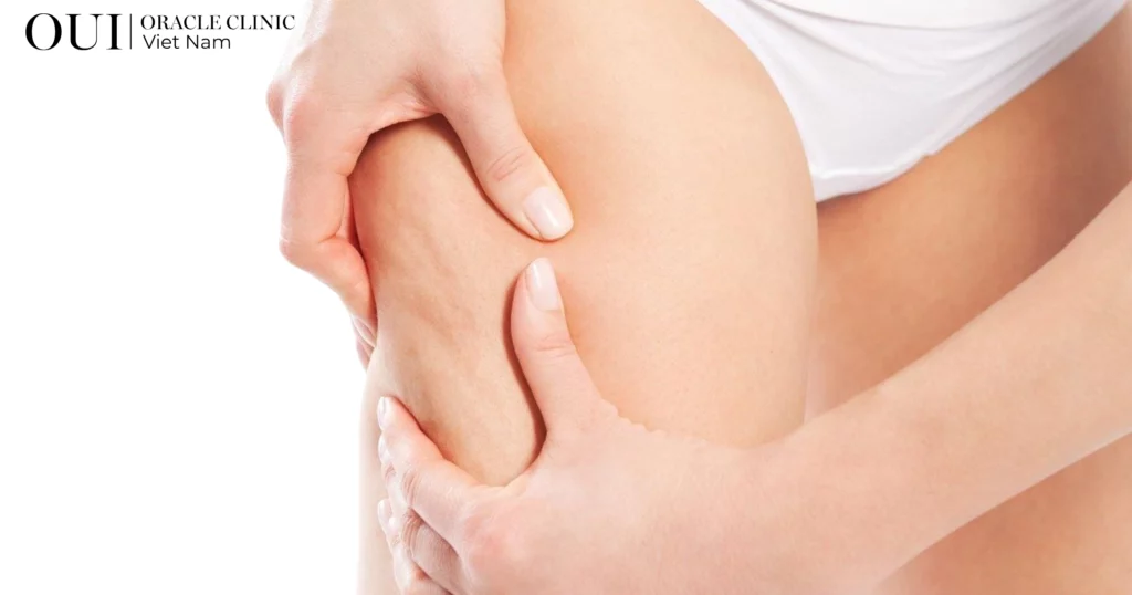 cải thiện body không tập gym