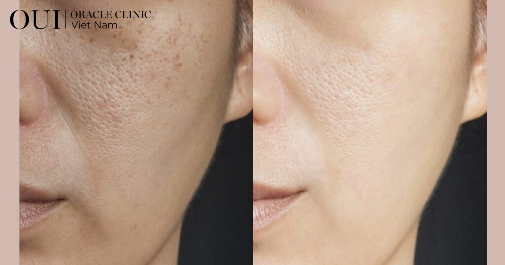 chăm sóc da định kỳ về độ ẩm và bề mặt da