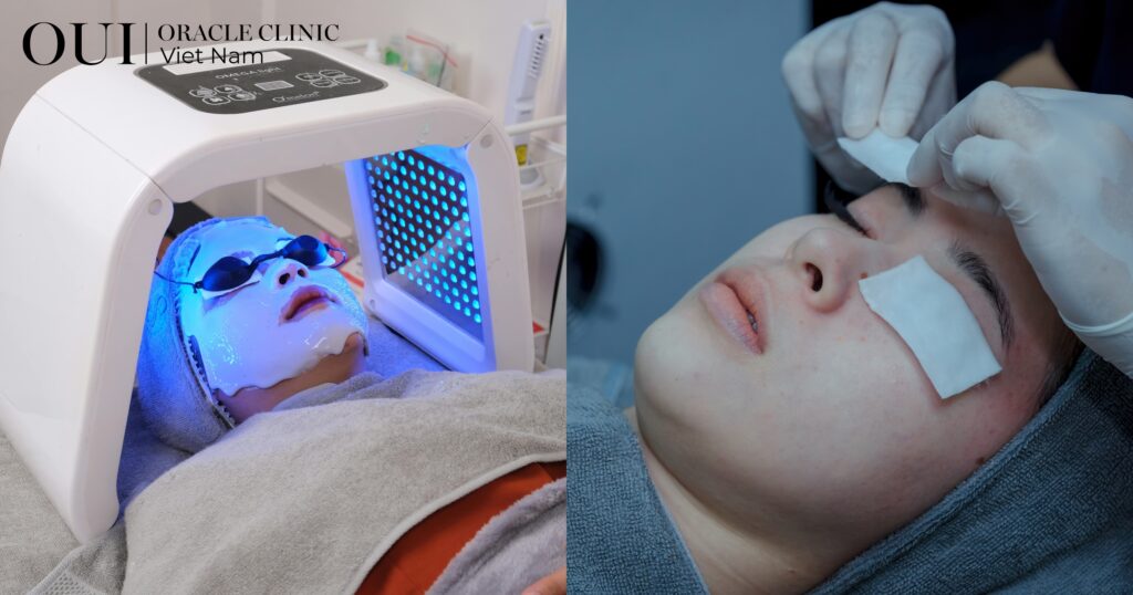 chăm sóc da định kỳ trị liệu bằng ánh sáng