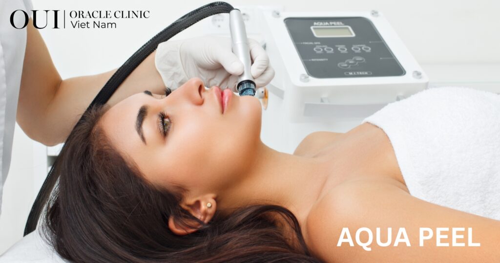 chăm sóc da định kỳ bao lâu 1 lần aqua peel