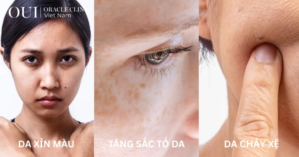 da lão hóa do ánh sáng xanh dấu hiệu nhận biết da lão hóa