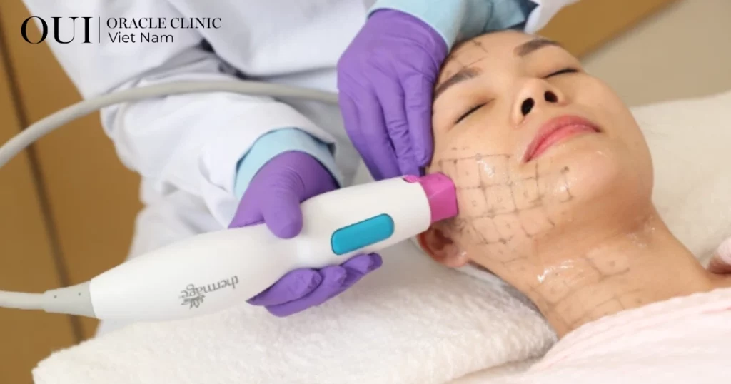 da lão hóa do ánh sáng xanh thermage FLX