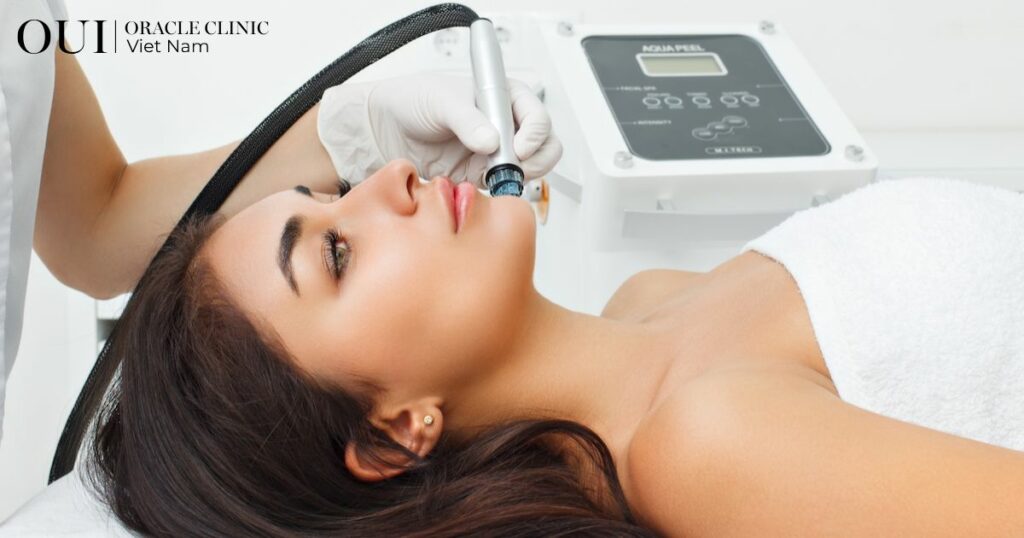 Da mất nước mùa hè Aqua Peel