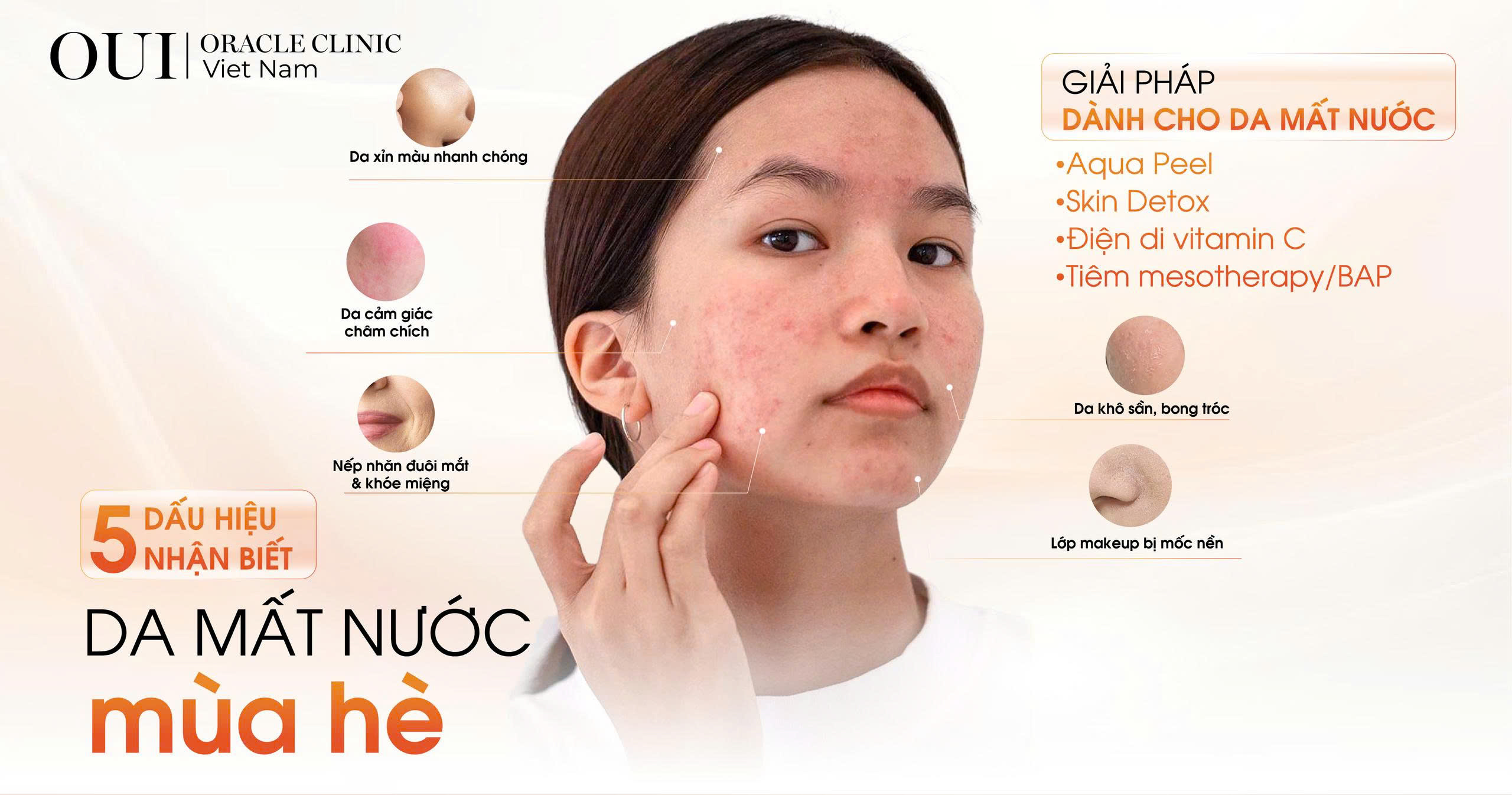 da mất nước mùa hè
