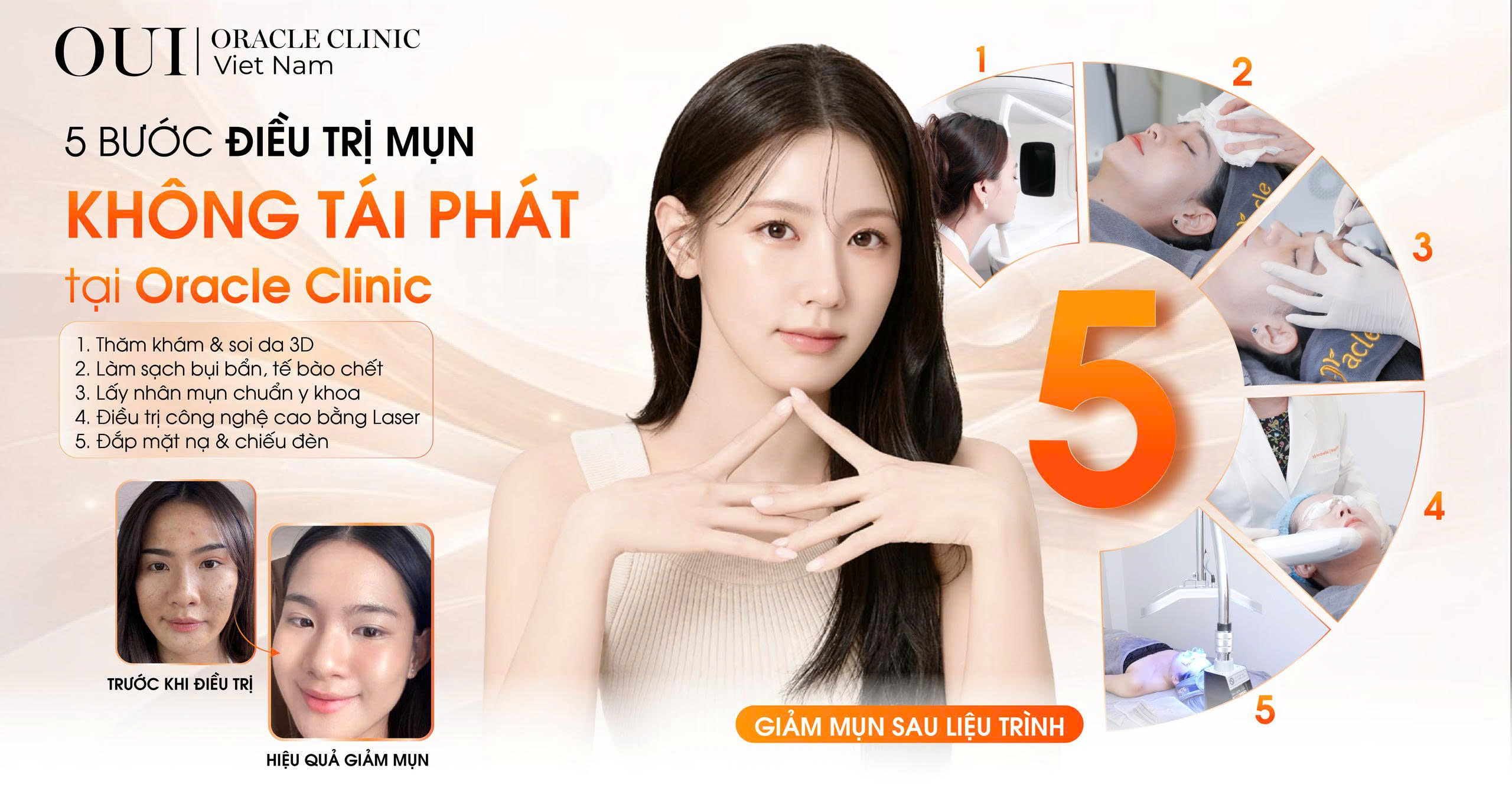 điều trị mụn không tái phát