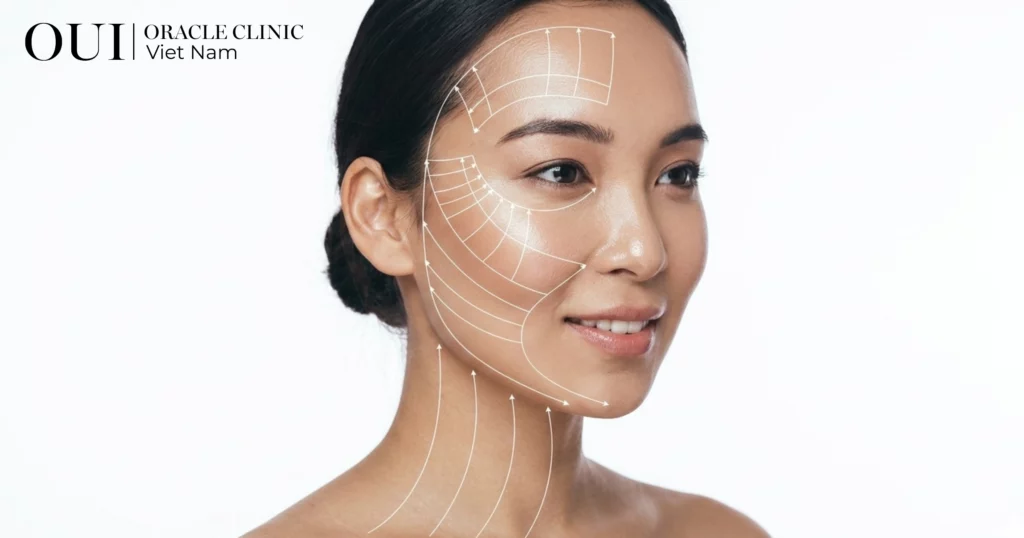 Nâng cơ có bị chảy xệ lại không