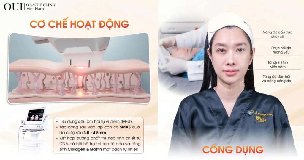 Nâng cơ có bị chảy xệ lại không