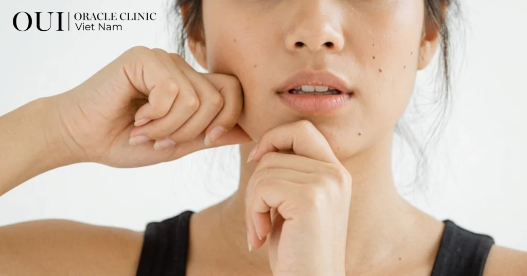 Nâng cơ có bị chảy xệ lại không