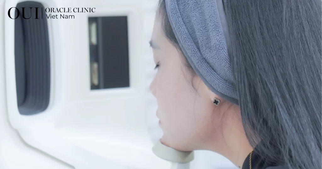 Nâng cơ có bị chảy xệ lại không