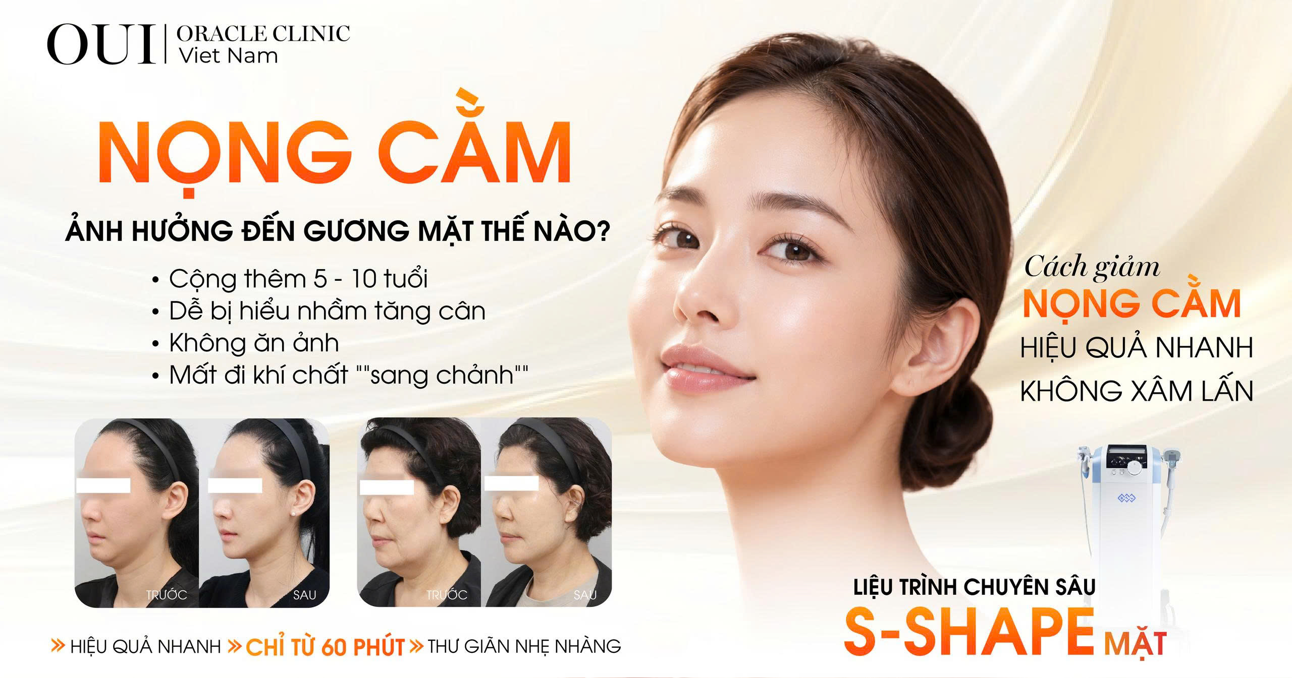 nọng cằm khiến gương mặt già hơn bao nhiêu tuổi