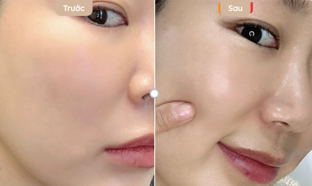 detox da có cần thiết