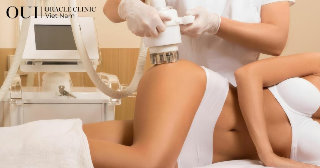 siết dáng công nghệ cao