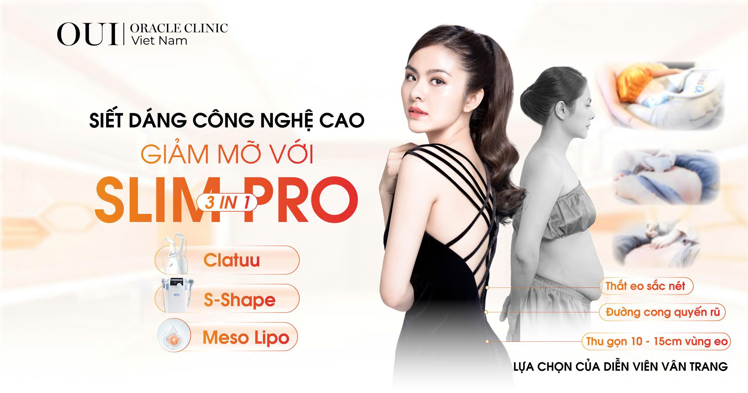 siết dáng công nghệ cao
