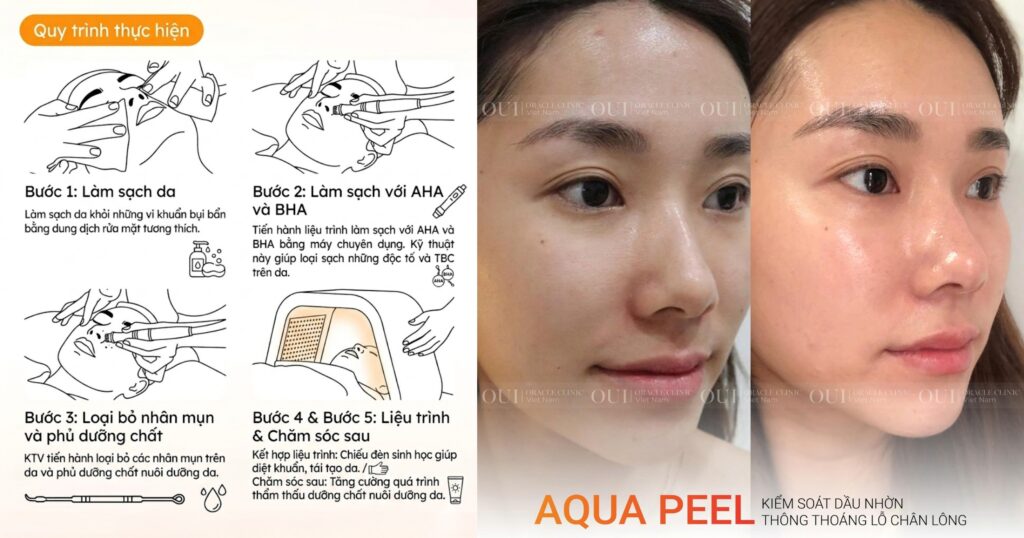 tia UV gây lão hóa da như thế nào Aqua Peel