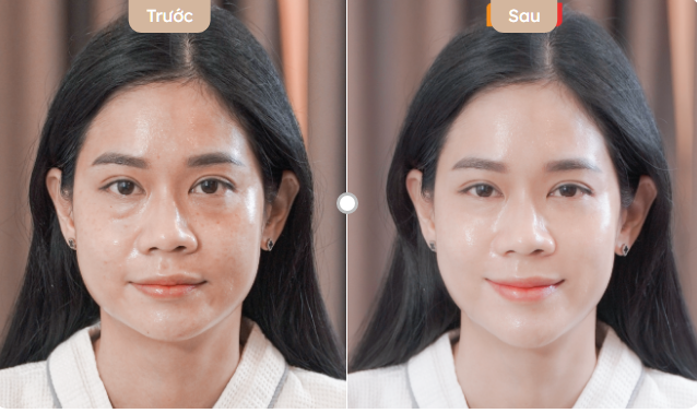 Trẻ hóa da sau 30