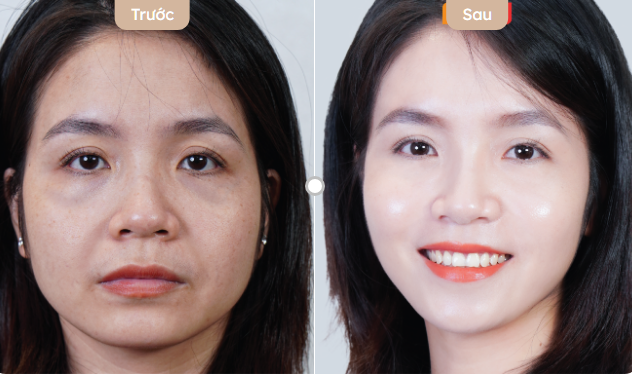 Trẻ hóa da sau 30