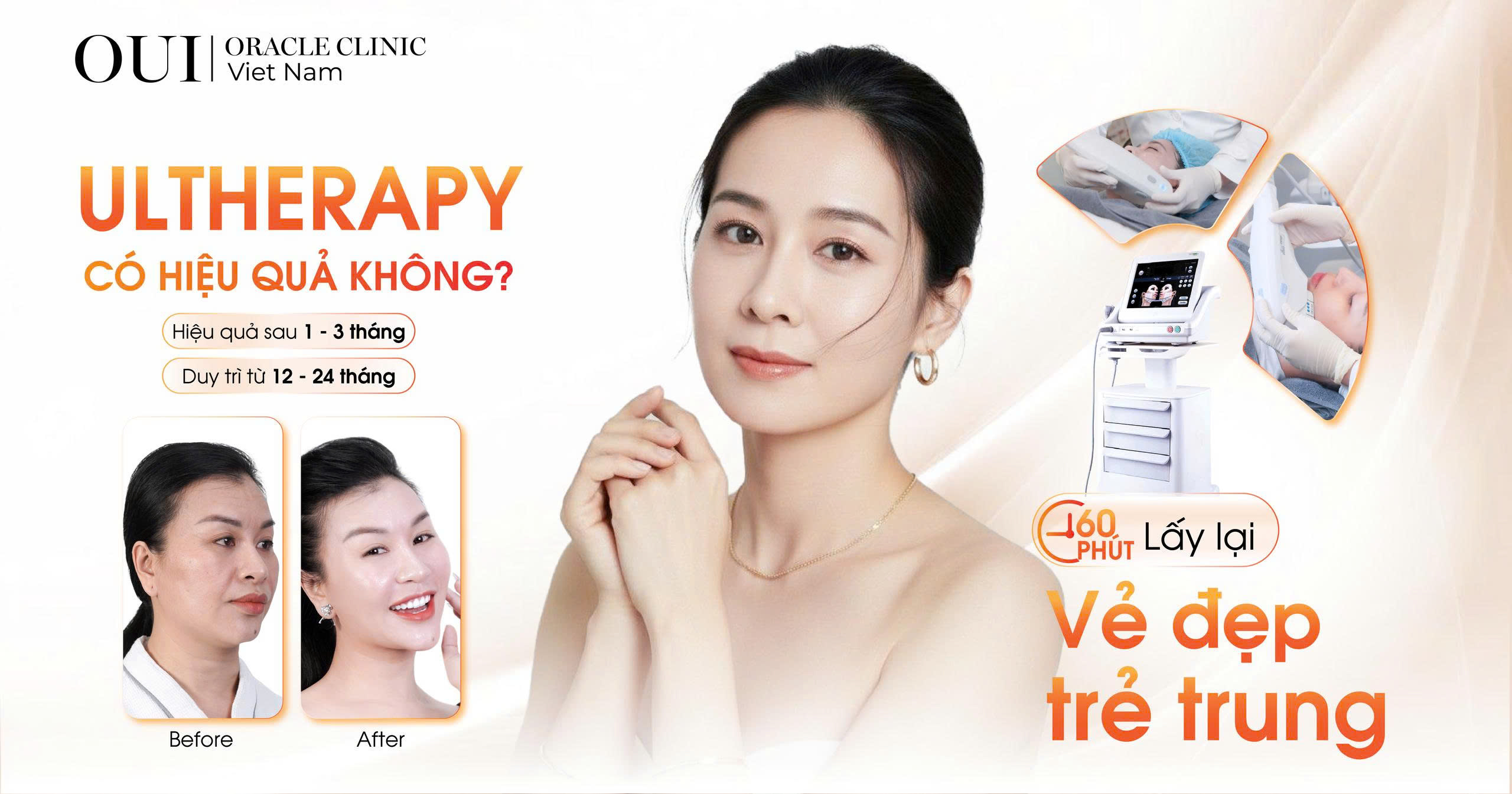 ultherapy có hiệu quả không