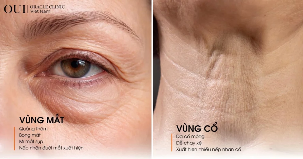 Xu hướng trẻ hóa da