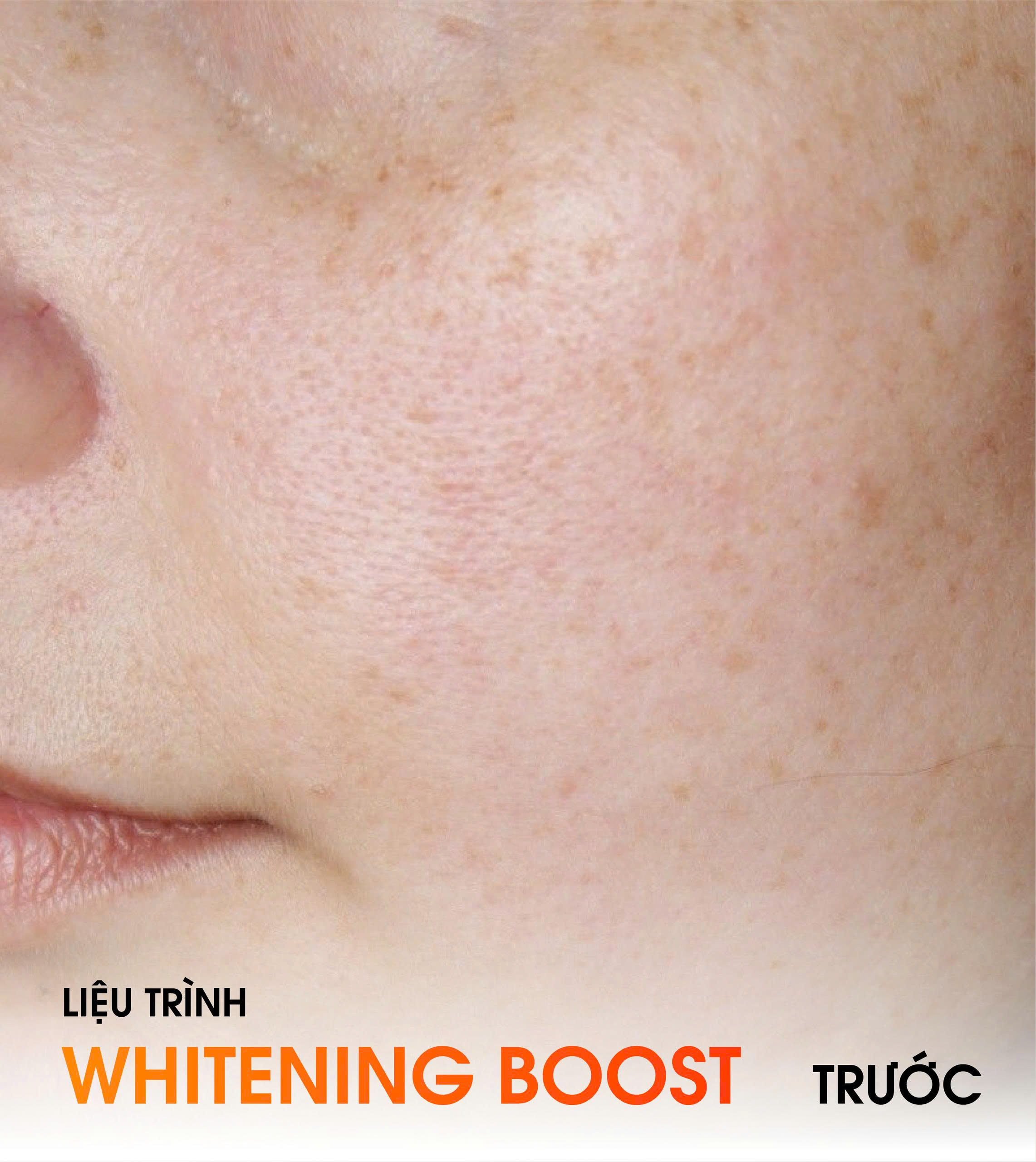 After Whitening Boost