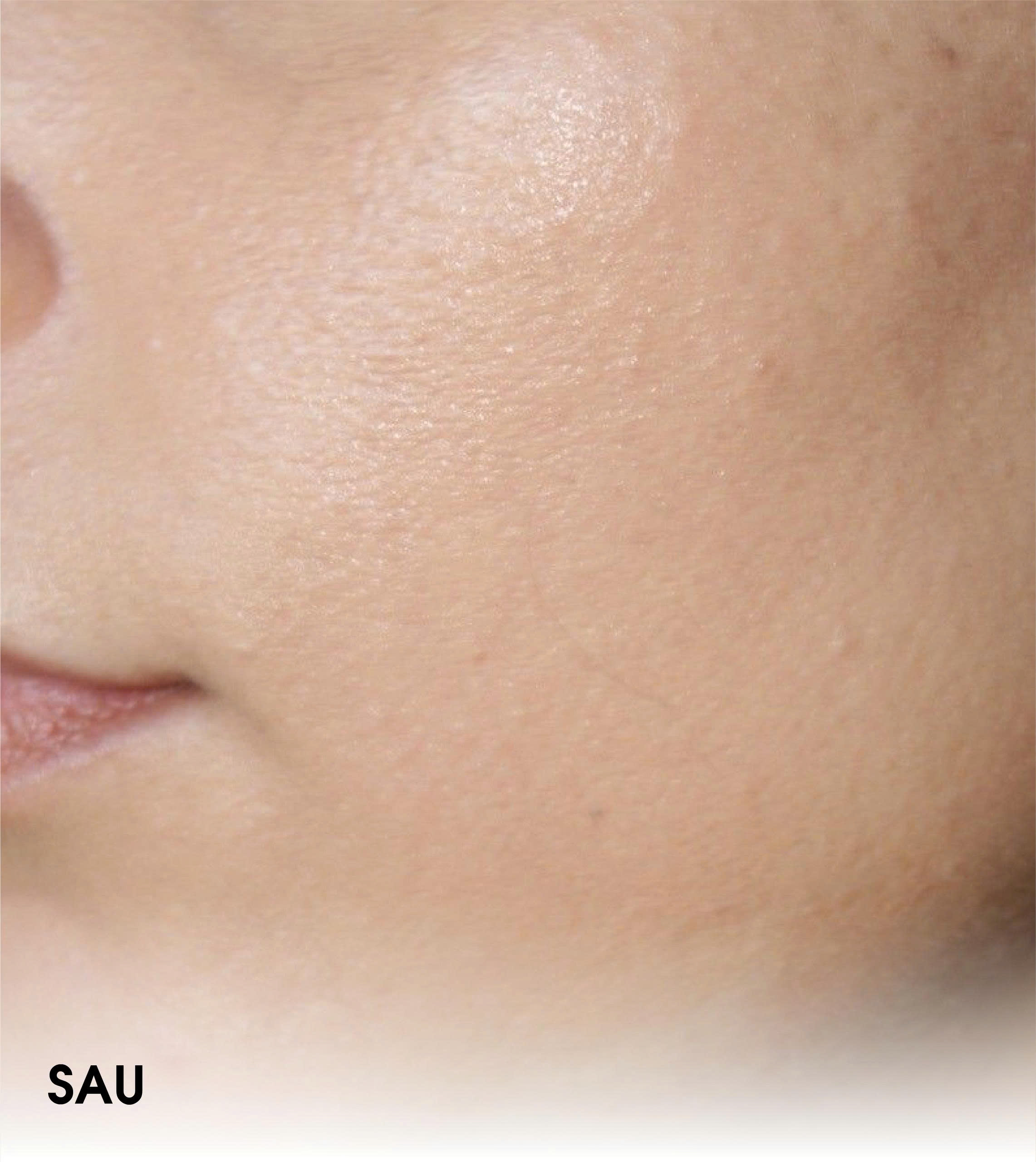 After whitening boost