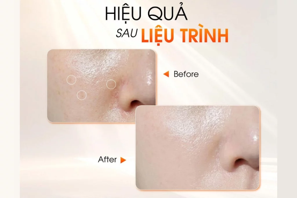 ăn gì để da đẹp từ bên trong