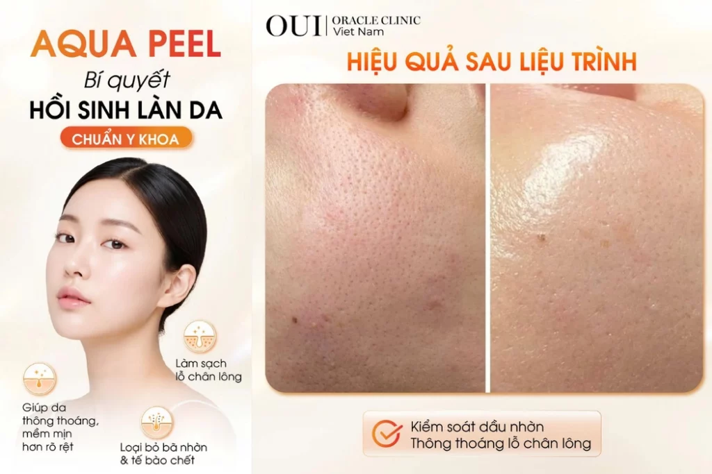 ăn gì để da đẹp từ bên trong