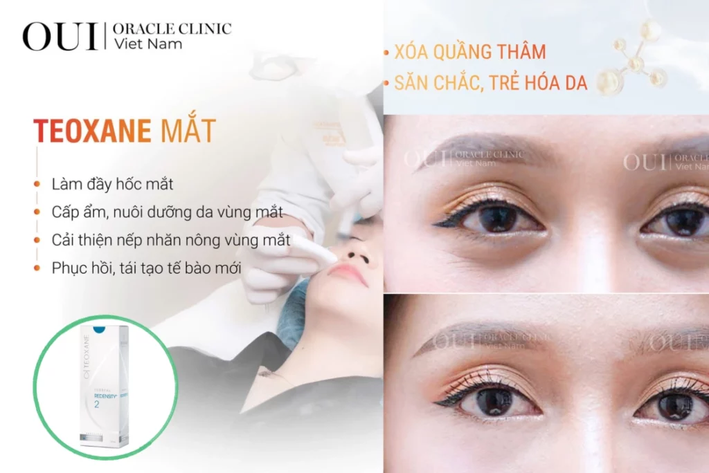 cách xóa nhanh nếp nhăn đuôi mắt 