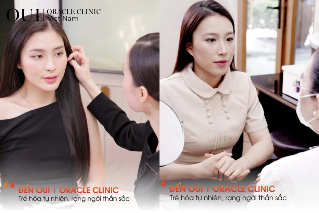 cách xóa nhanh nếp nhăn đuôi mắt 