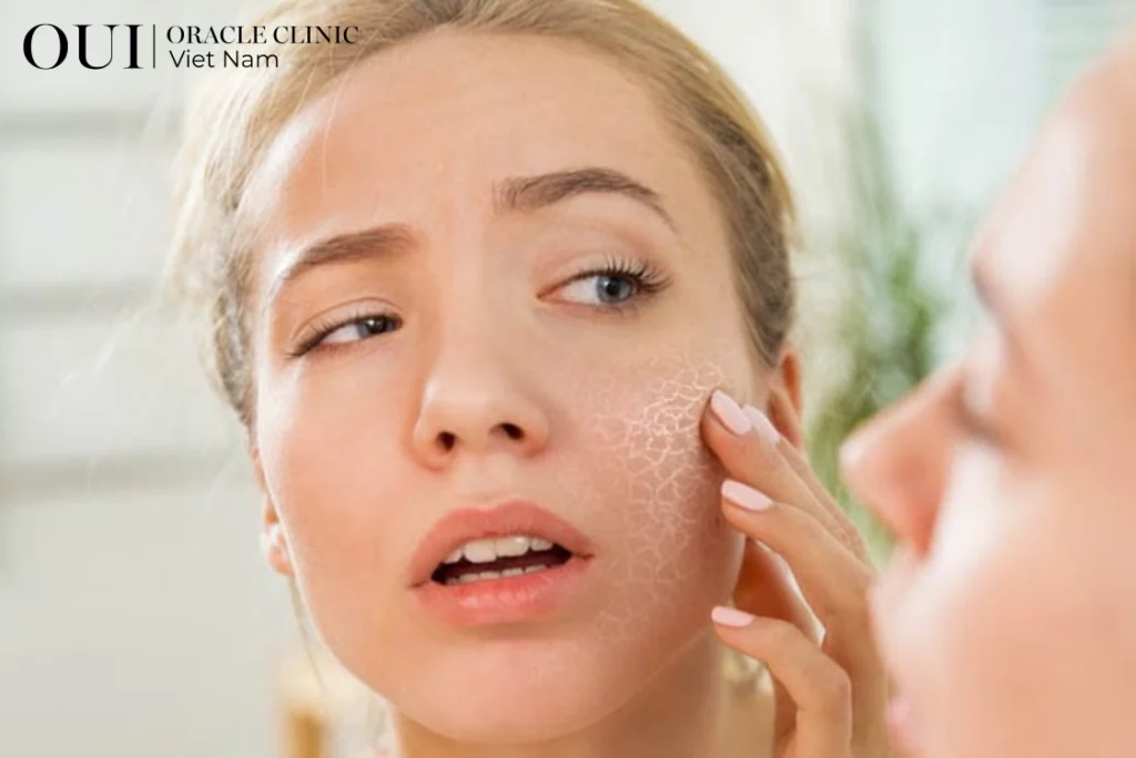 cách xóa nhanh nếp nhăn đuôi mắt 