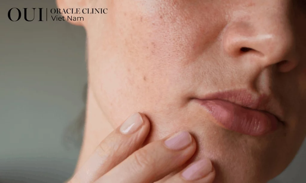 da bị khô khi ngồi điều hòa