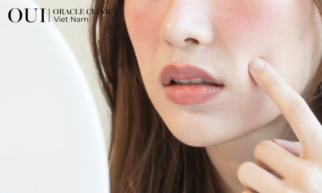 da bị khô khi ngồi điều hòa