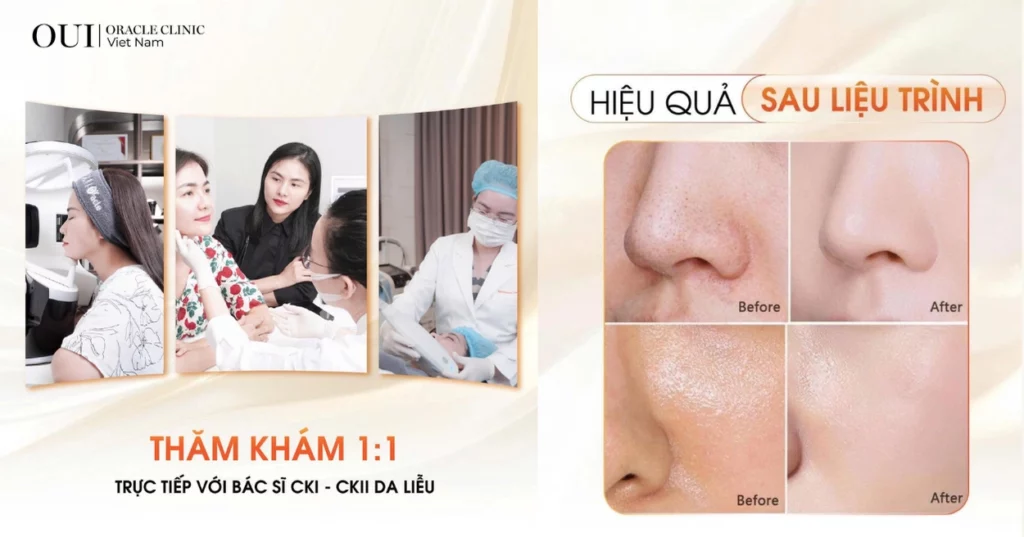 da căng bóng Hàn Quốc