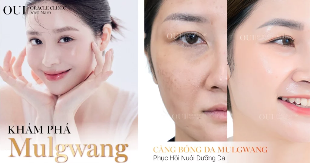 da căng bóng khác da dầu