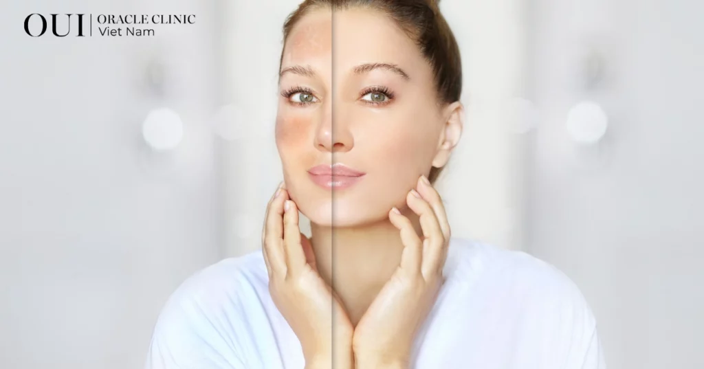 da căng bóng ngậm nước