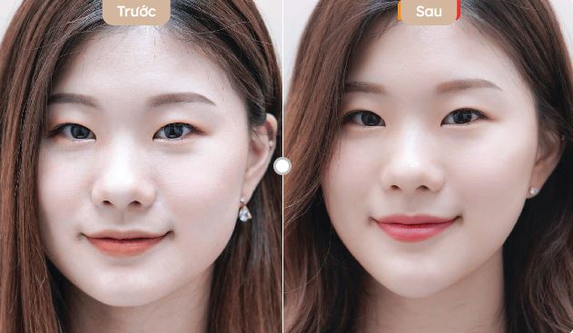 da căng bóng ngậm nước