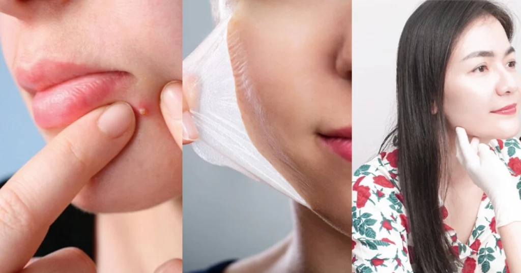 da đổ dầu nhưng vẫn khô