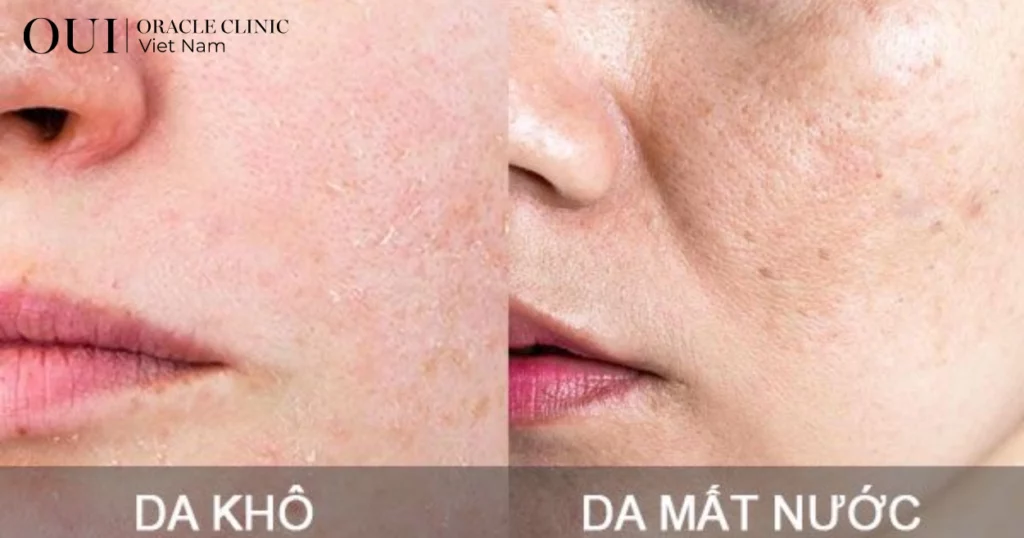 da đổ dầu nhiều nhưng vẫn khô