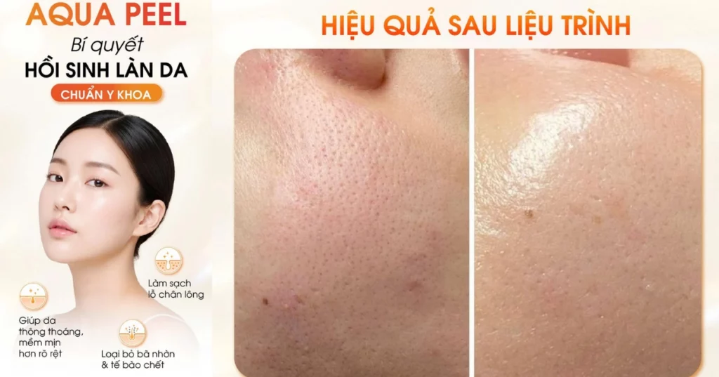 da đổ dầu nhiều nhưng vẫn khô